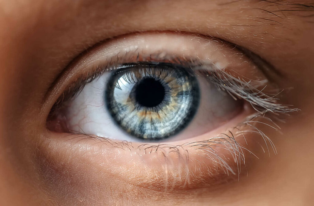 A close up of a person's eye who is seeing yellow spots in their vision