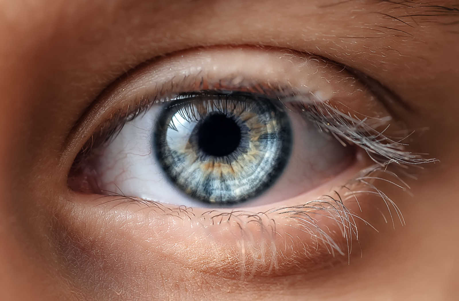 Doctor, doctor: What's causing the yellow streaks in my eyes?, Health &  wellbeing