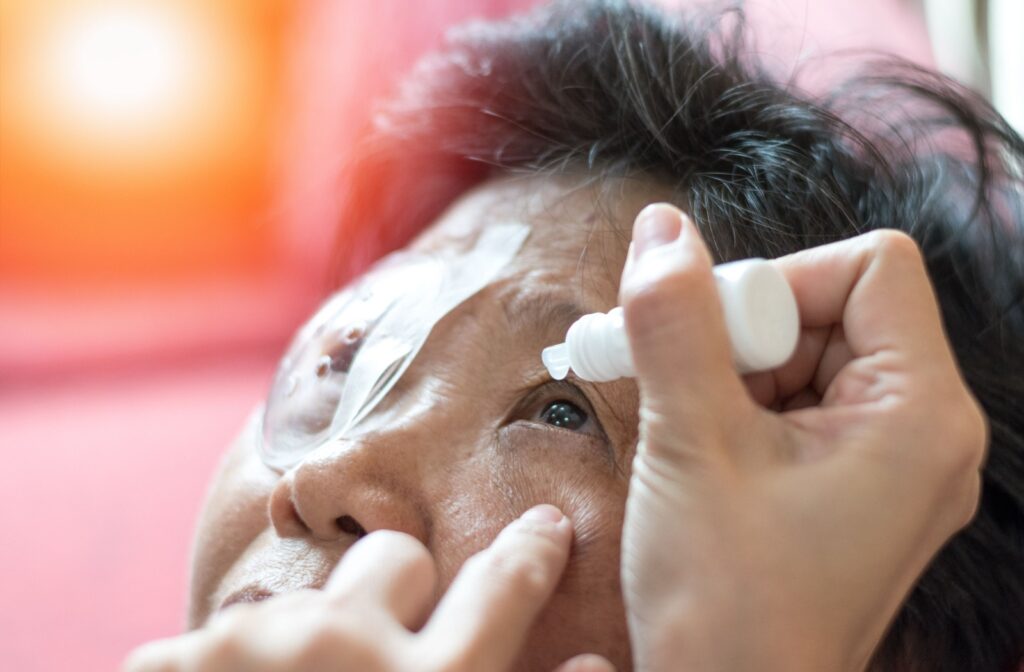 Old woman patient using eye drops on her eyeball, with a protective shield over the other side, as part of post-cataract surgery recovery.
